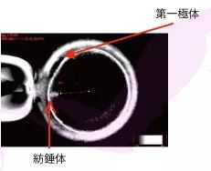 惠州代生哪里好,肥胖+多囊赴美做试管婴儿，怎样定IVF方案?-上海公立供卵医院