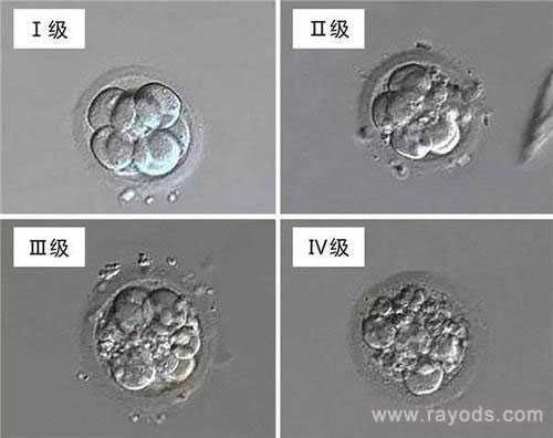 赤峰代孕哪里最便宜_杭州助孕试管婴儿妊娠高血压的分类