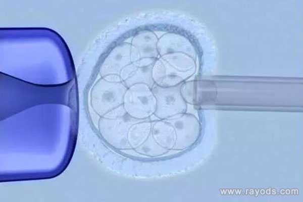 黔江代孕要多少费用_黔江代孕最新价格表_宫腔镜检查对于日本试管婴儿胚胎移